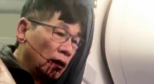 怒了！美联航暴力殴打驱逐亚裔乘客！-纽约